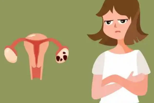 患巧克力囊肿不做手术十年内必发生恶变的说法是真的吗？