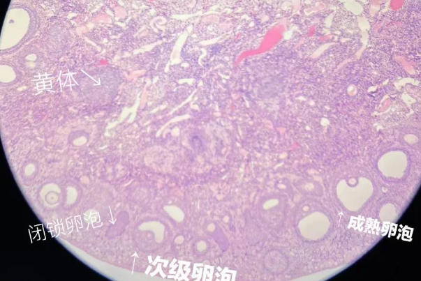 卵泡黄素化b超显示越来越大