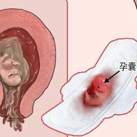 自然流产胚胎染色体检查怎么保存卵泡?牢记禁止干燥和冷冻
