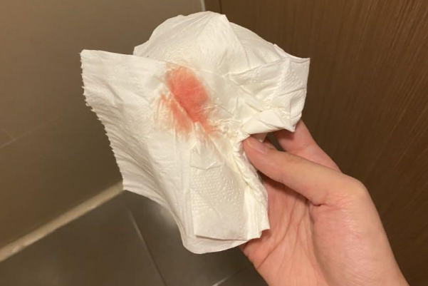 着床出血的量较少