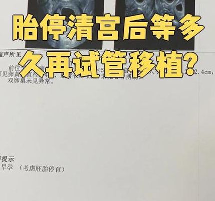 试管移植失败后多久可以自然备孕？看有没有清宫差别很大