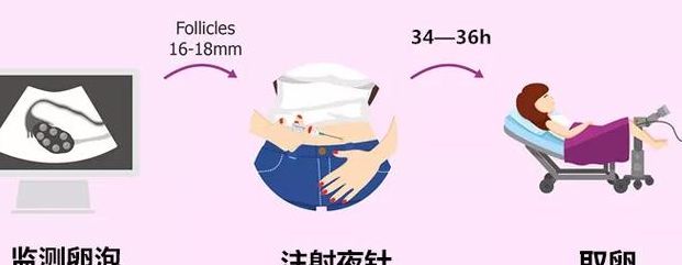 试管卵泡多大打夜针最合适？我17mm就打了