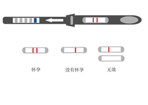 假性怀孕会显示两杠吗假性怀孕会腹痛吗