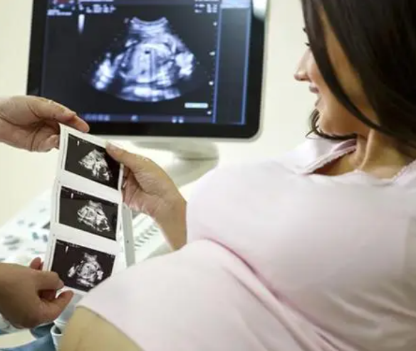 人工受孕能筛选胎儿性别