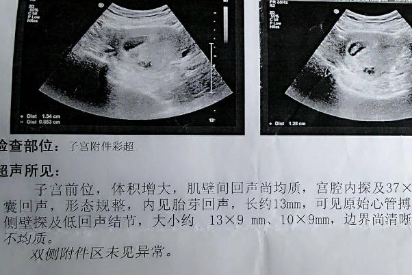 怀孕7周怎么通过孕囊数据看出宝宝是男孩还是女孩呢？