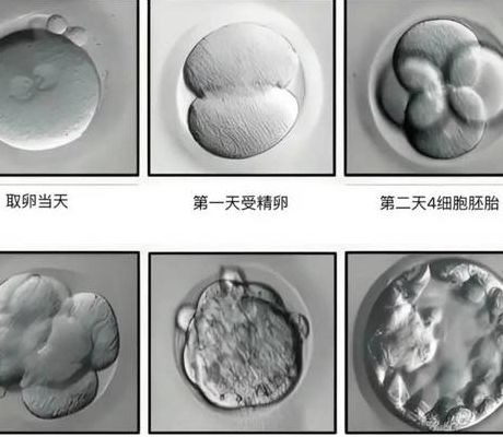 试管婴儿真的质量好吗？三个角度看清胚胎等级与成功率
