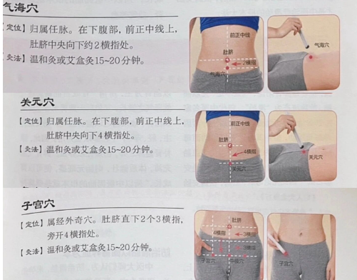 艾灸助力好孕来：找准穴位，科学备孕有妙招