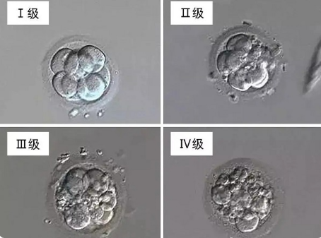 1代试管能看到胚胎质量等级吗?