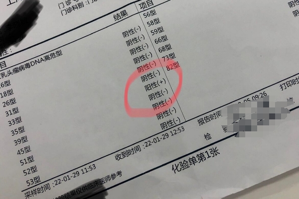 hpv检测的准确性受多种因素的影响