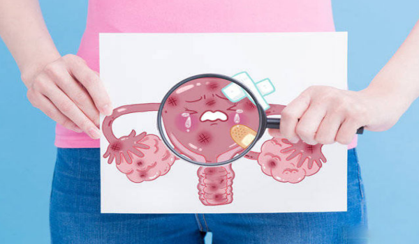 孕期子宫肌瘤的注意事项