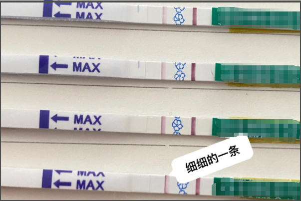 hcg浓度会影响大卫试纸的颜色