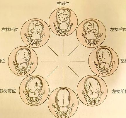 6个症状说明你胎停了，这4个判断维度最关键