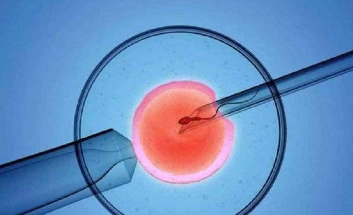 青岛同性恋伴侣的试管婴儿