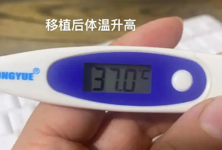 试管移植后发热