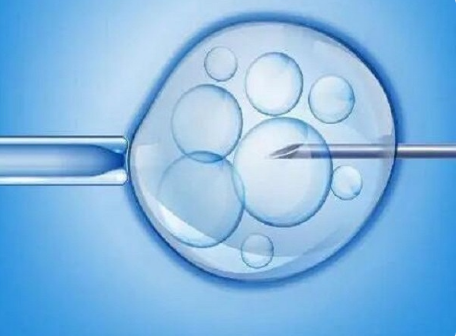 多囊卵巢试管生龙凤胎概率有多大?