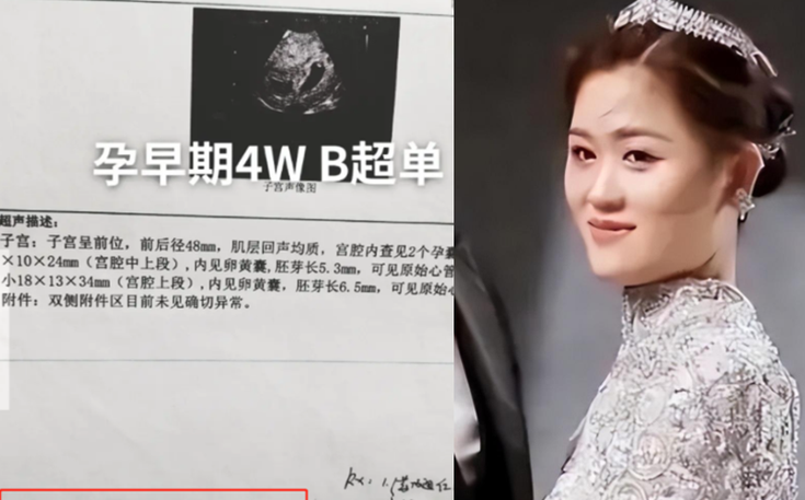 成都试管双胎多少钱？过来人帮你拆解6笔开销明细