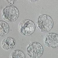 4ba囊胚质量怎么样？移植成功率高不高？一次给你讲明白