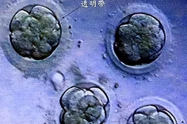 高龄女性胚胎质量不好也有移植的可能
