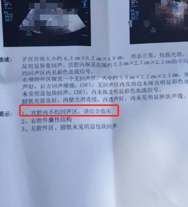 试管婴儿没成功需要做人流吗?关键看宫腔有没有残留