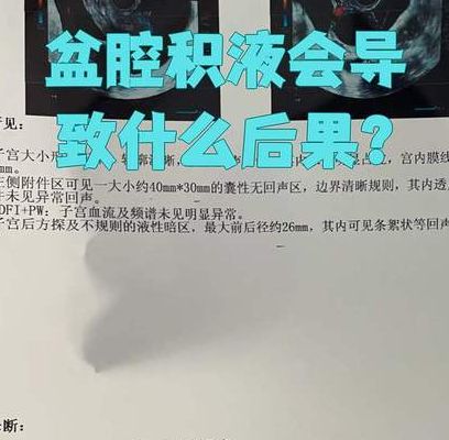 宫腔积液对试管移植有什么影响吗女性？先看量和位置再决定