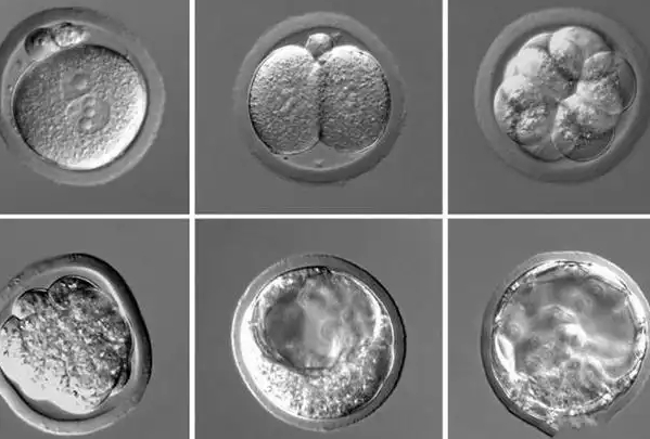 养囊风险大还建议养囊 养囊风险大还建议养囊