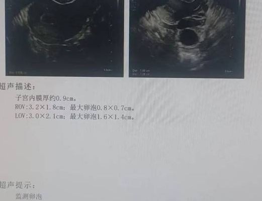 试管卵泡长到多大就可以取了？关键看这3个指标