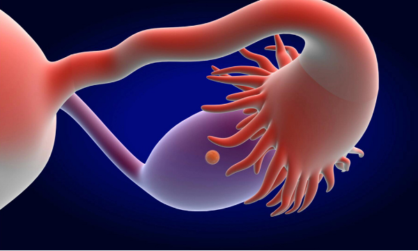 卵巢囊肿怀孕的危险情况