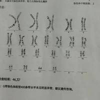 染色体异常可以做试管吗女性？先分清类型再选对方案