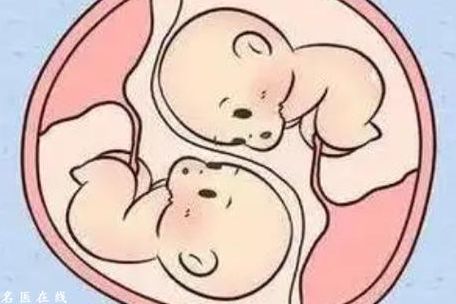 试管婴儿双生子价格多少钱？过来人帮你梳理费用明细
