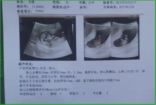 nt检查可以不在同一家医院做