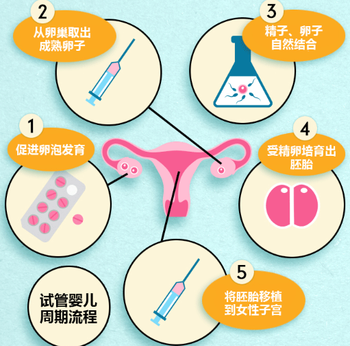 12步看懂试管婴儿全流程，治疗需要几天大概就有数了
