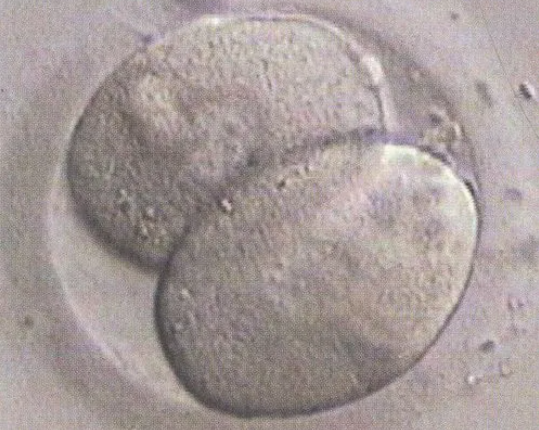 1级胚胎不着床有很多原因