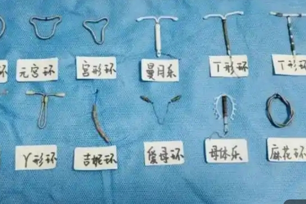不同节育环避孕时间有差异
