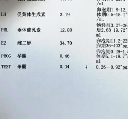 性激素六项哪项看不孕？2026年共识解读：先看FSH这一项