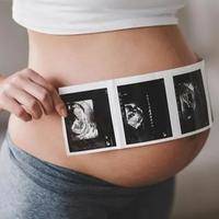 备孕必看！解锁优生优育的四大黄金法则