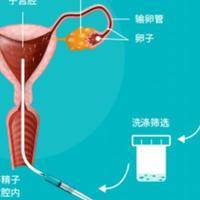 去俄罗斯试管价格是多少？过来人帮你梳理6笔开销明细多少钱