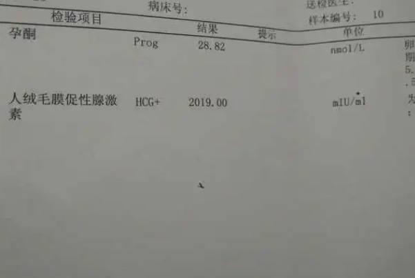宫外孕hcg水平可能会超过一万