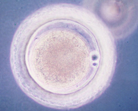 怎么改善胚胎透明带厚,请问卵子透明带厚可以生育吗？