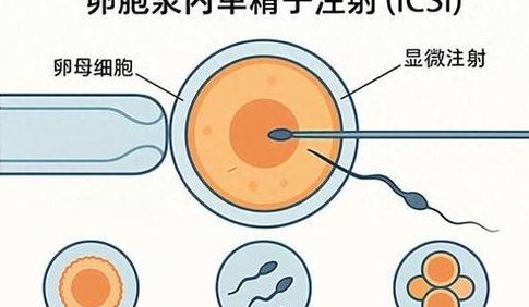 试管卵泡多大可以卵母细胞采集？18毫米不是专业定制标准