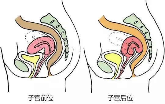 下载.webp.jpg