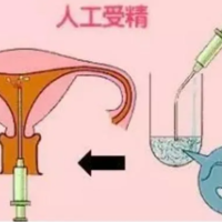 山东代孕生子收费山东济南可以做三代试管公立医院有哪些