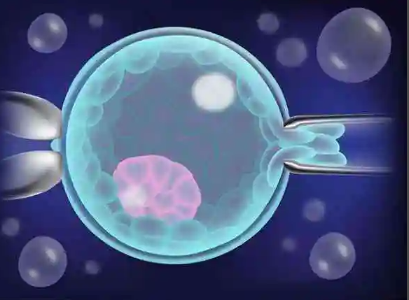 多囊适合移植冻胚