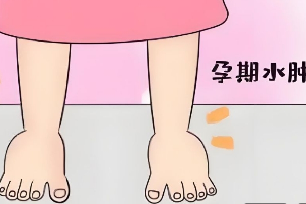 为什么生男孩容易脚肿，源于孕妇的个人体验或传统认知