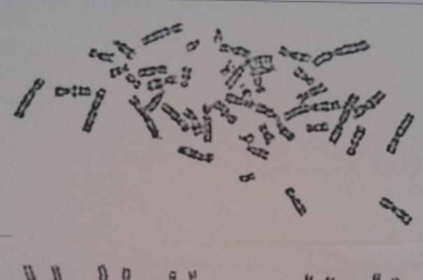 检查染色体挂什么科，科室选择的黄金法则