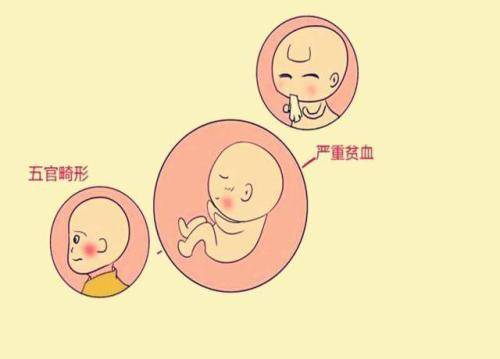 胎儿致畸因素.jpg