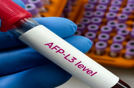 孕妇甲胎蛋白对照表