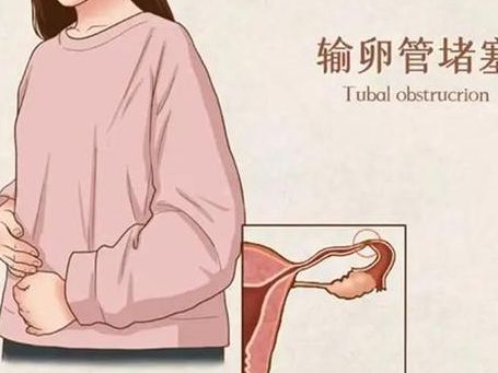 试管移植后能侧着身子睡吗？不能平躺的姐妹看过来