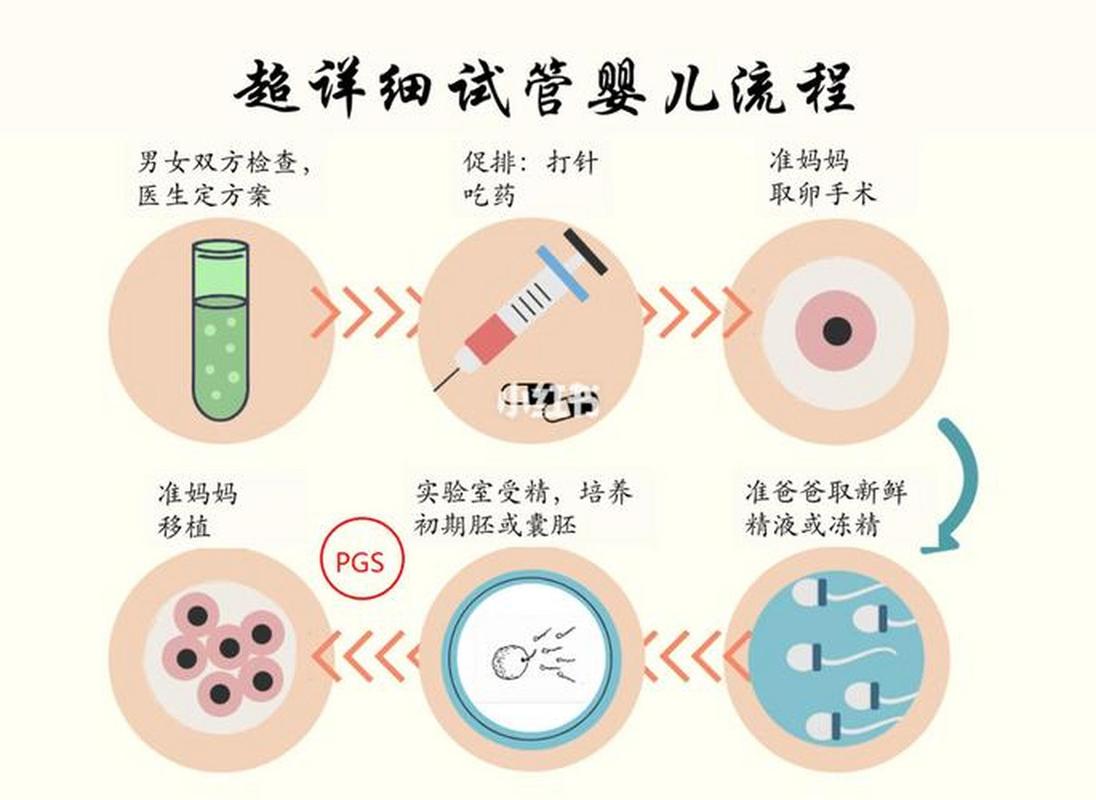 有在成都试管的吗医生不会直接告诉你的费用真相