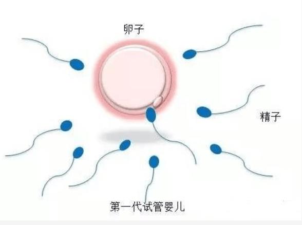 做试管一代和三代有何区别？自然结合还是基因筛查
