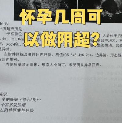 阴超最早几天查到孕囊？别等到停经40天再查